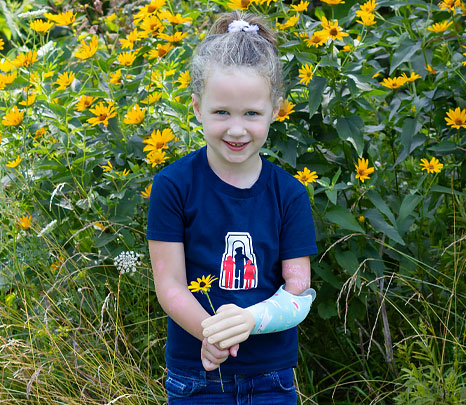 Une jeune fille amputée d’un bras se tient debout devant un champ de fleurs en souriant.