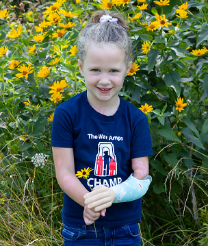 A young female arm amputee smiles and stands in front of a field of flowers.