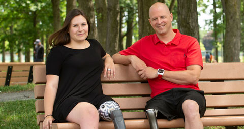 A female adult leg amputee and a male adult leg amputee sit on a bench in a park.
