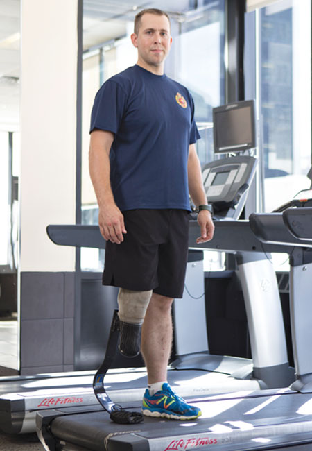 An adult leg amputee wearing a running prosthesis stands on a stopped treadmill.