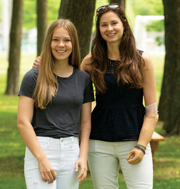 A female young adult arm amputee stands beside a female adult arm amputee in a park.