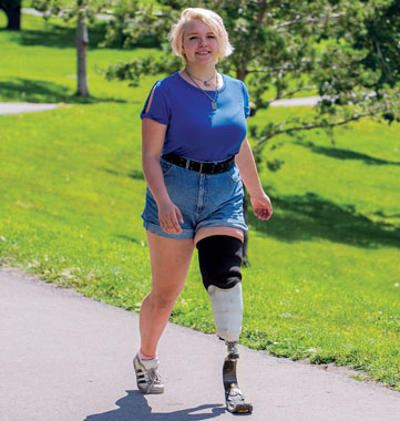 A teenaged female leg amputee walks on a path in a park.