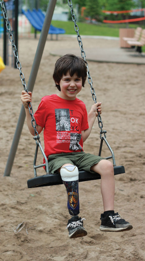 A young male with a Syme’s amputation smiles big while seated on a swing.