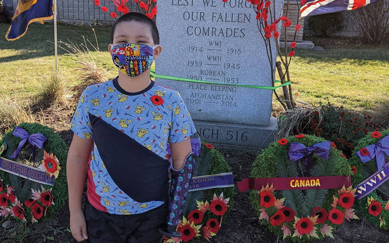 A young male arm amputee stands in front of Remembrance Day wreaths at a cenotaph.