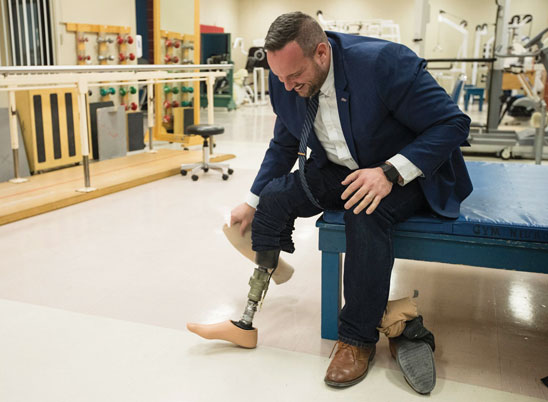 A male adult leg amputee sits on a bench at the prosthetist's office.