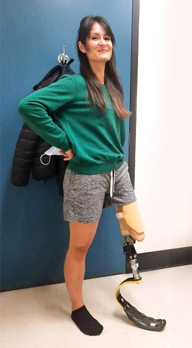 Une femme amputée d’un bras et d’une jambe est debout dans le bureau d’un prothésiste.