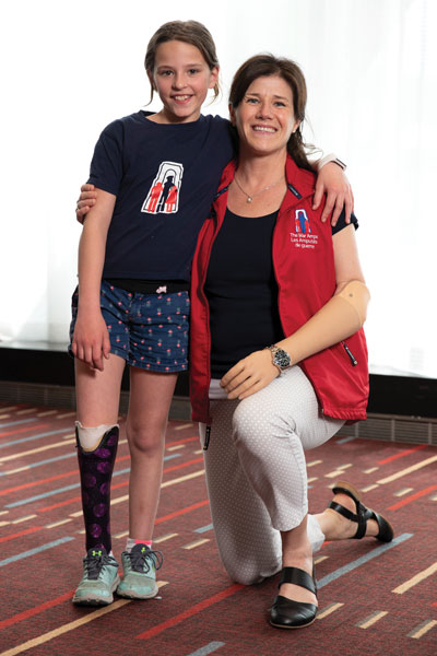 A young female leg amputee stands with her arm around a female adult arm amputee who is kneeling to match her height.