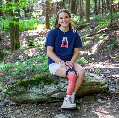Une adolescente amputée d’une jambe est assise sur une grosse roche dans une forêt.