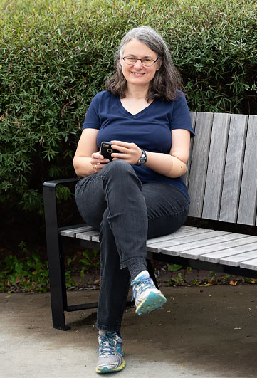 A female adult arm amputee sits on a park bench and uses her cell phone.