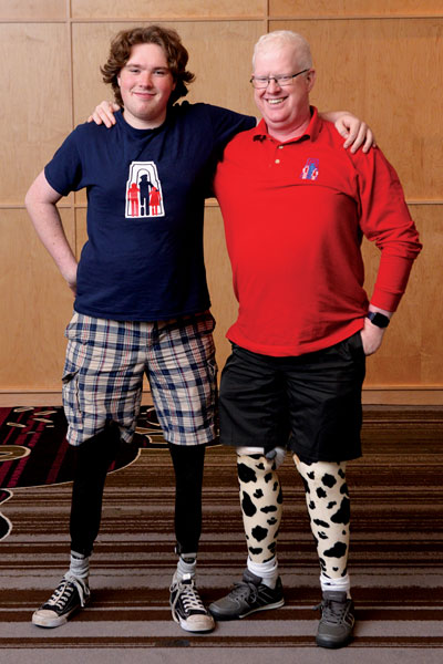 A young adult male double leg amputee stands with his arm around an adult male who has a bilateral Syme’s amputation.