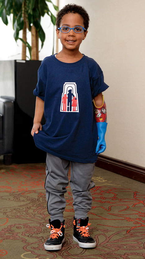 A young male arm amputee stands in a hotel lobby.