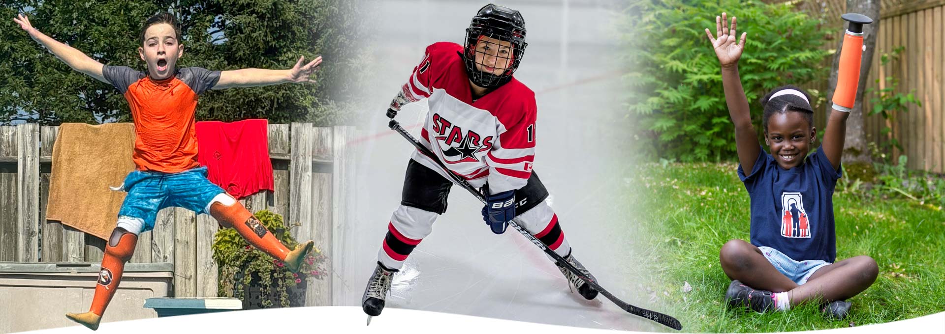 Young amputees playing and having fun.