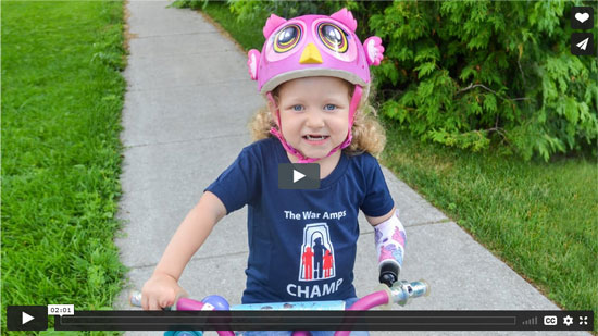 Michaela using her artificial arm with a bike attachment to ride her bike. Watch Michaela's story.