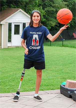 Champ Rebecca, a leg amputee, spinning a basketball with her finger.